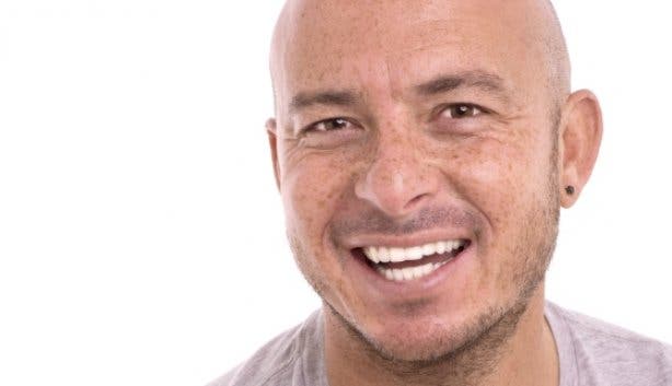 Zoom Whitening_Herschelle Gibbs